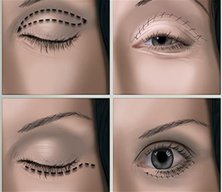 Op Dr Huseyin Altun Op Dr Huseyin Altun